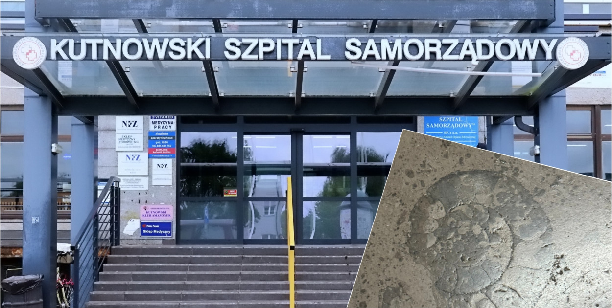SOR jak muzeum? Pacjentka odkryła skamieliny na podłodze szpitala 